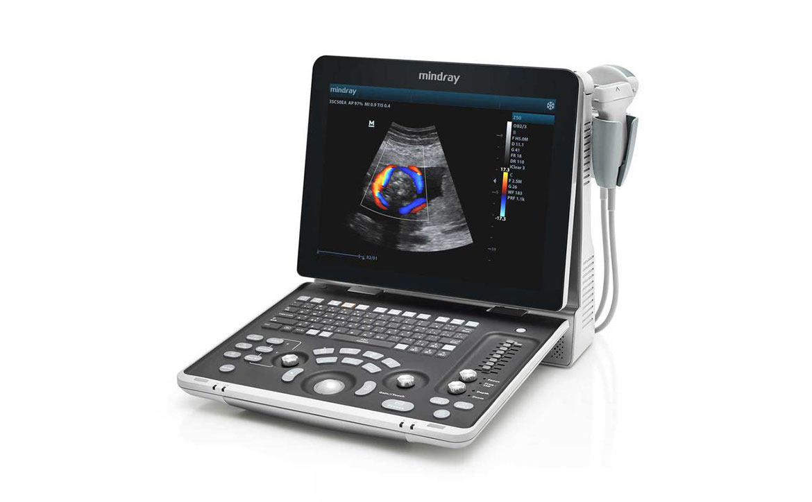 Z50 Diagnostic Ultrasound System